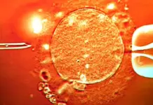 Skandal në Europë: Dhuruesi i spermës me mutacion kancerogjen sjell në jetë 197 fëmijë – disa kanë humbur jetën