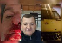 U dhunua brutalisht në paraburgimin e Vlorës biznesmeni Eduart Alikaj/ U futën në qeli dhe e goditën barbarisht