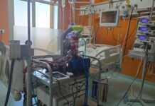 Për herë të parë në Shqipëri/ Mjekët e “Shefqet Ndroqit” realizojnë me sukses terapinë ECMO, shpëtohet një paciente 63-vjeçare