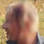 Dhunohet 60-vjeçari në Tropojë, përfundon në spital! Akuza ndaj fqinjëve dhe Policisë për mosveprim