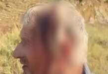 Dhunohet 60-vjeçari në Tropojë, përfundon në spital! Akuza ndaj fqinjëve dhe Policisë për mosveprim
