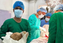 FOTO/ Tronditëse në Sri Lanka! Mjekët heqin gurin gjigant 3.1 kg nga fshikëza e 55-vjeçarit